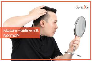 Mature Hairline